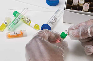 Numerous enclosed vials containing various samples, with a scientist applying a cap label to one of the vials for precise identification.