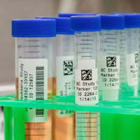 Multiple samples are labeled with QR codes.