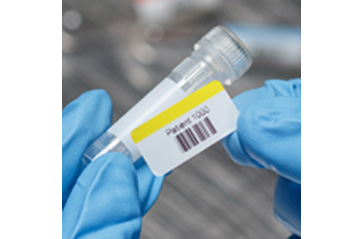 Scientist applies a pre-printed adhesive laboratory label to a specimen container.